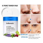 Zero Pore Toner Pads Control Oil Reduce Sebum Exfoliate Deep Clean Refines Pores Antioxidant Skincare Treatment Skincare Korean